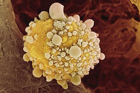 Bukspottkörtelns funktion – Cancer.se.